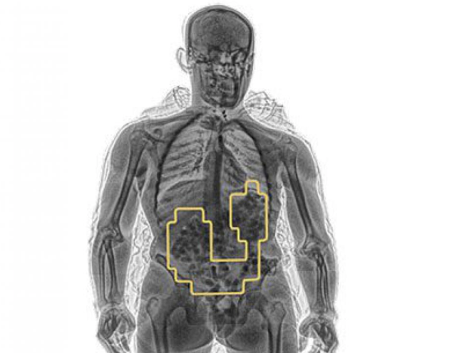 X-Ray Body/Person/Human Scanner - Image 4